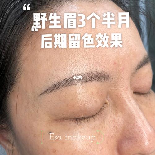 顾客实例 野生眉后期留色效果_野生眉_美妆_医美整形