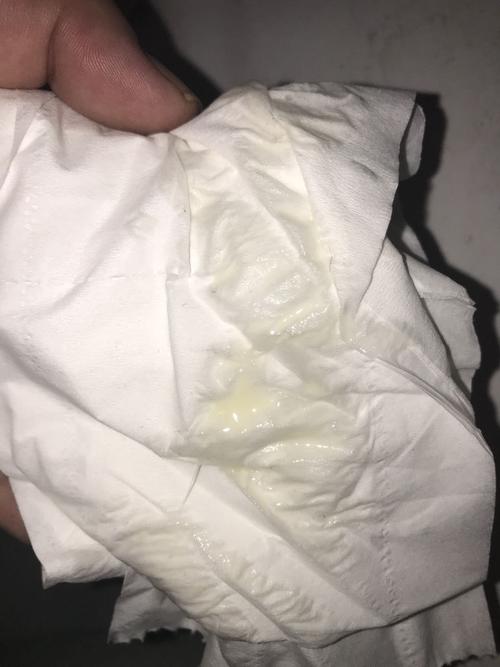 这样的白带正常吗?