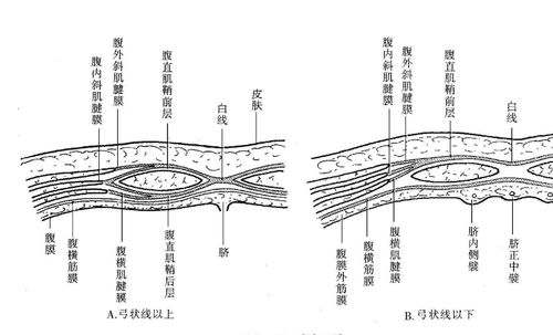 图3-59 腹直肌鞘