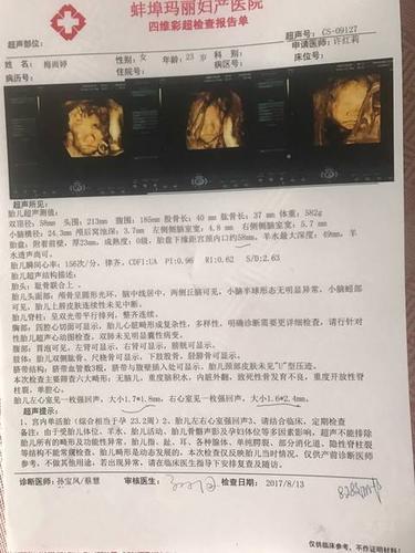 生男宝的四维超单子