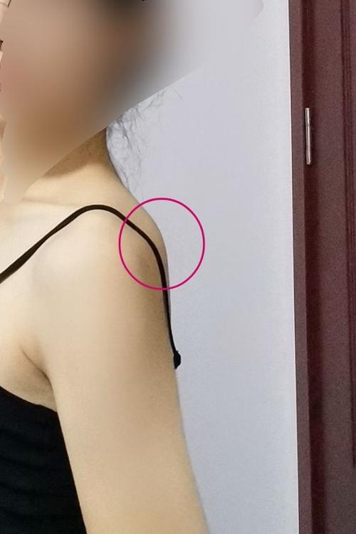 肩胛骨的位置正确吗?