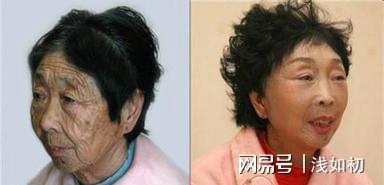 60岁安徽奶奶为了25岁的男友去做拉皮手术两人现状如何了