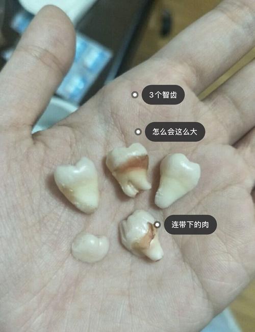 拔了3个智齿后,我真觉得杨幂没整容事情追溯到4年前