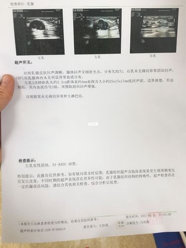 前庭大腺囊肿可以自愈不需要手术_艾灸_胸部_内裤_抵抗力_学习_前庭大