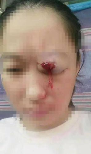 震惊!滨州某村修路拆屋起争执!开发商动用钢珠枪射击!有村民受伤!