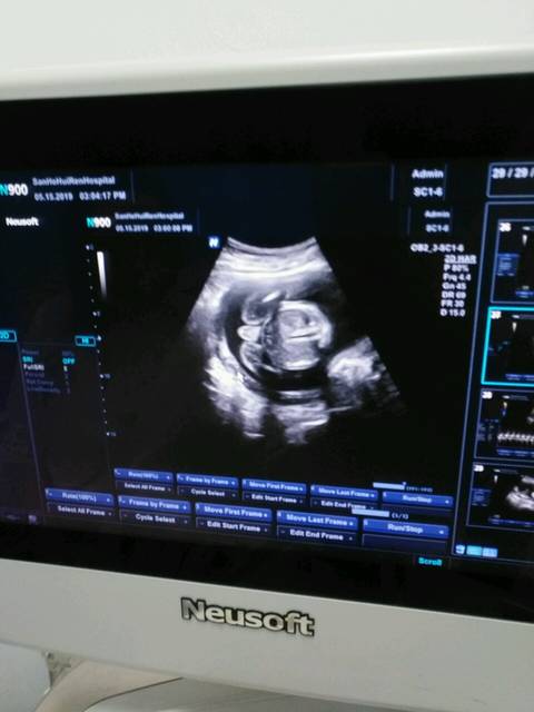 21 热乎乎的b超图,男孩