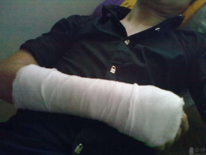 梦见手断了周公解梦,梦见手断了是什么意思?