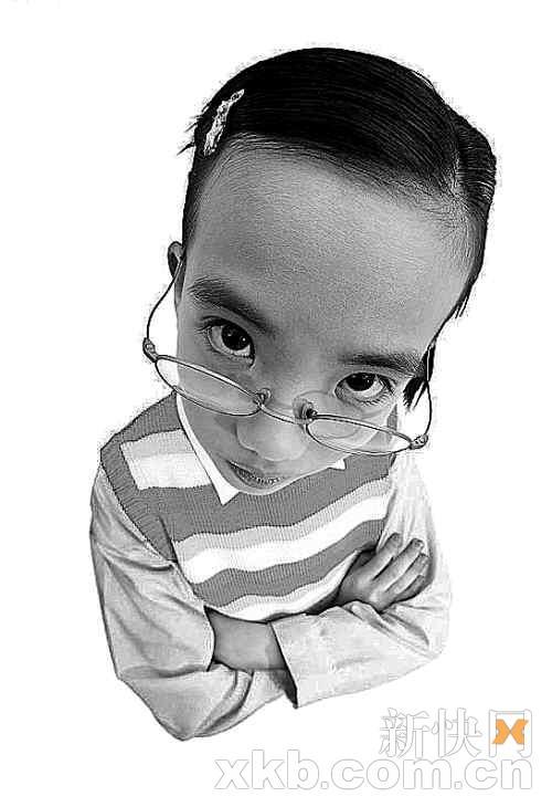 儿童斜视不容忽视(图)