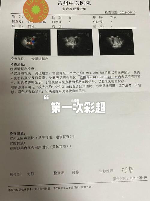 彩超结果_常州市妇幼保健院_孕酮_胎停_胎心_子宫_早孕宫腔积液_母婴