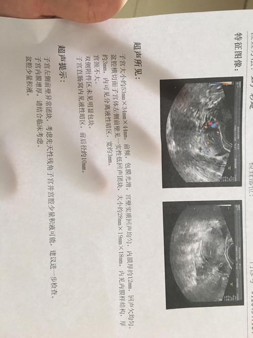 残角子宫内见内膜怎么办