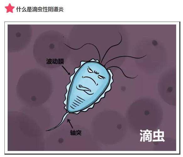滴虫阴道炎是怎么来的?