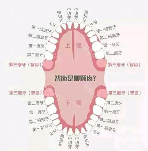 智齿真的直接决定着智商吗?