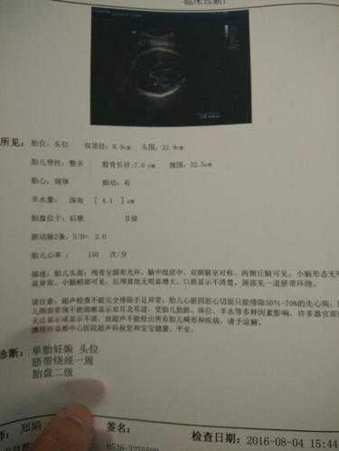 你好医生,怀孕35周 3天,是不是羊水量偏少?腹围是不是