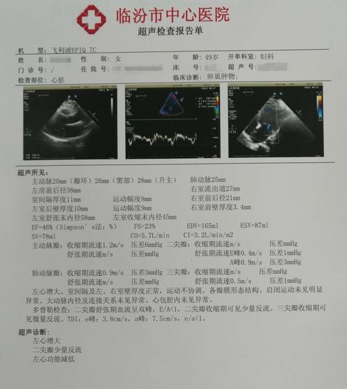 临汾市中心医院妇产科-卵巢癌