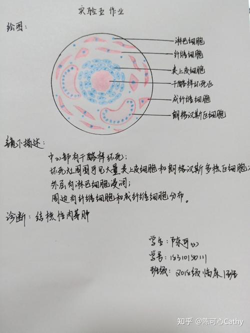 病理学红蓝铅笔绘图 实验作业