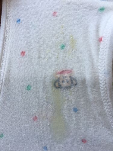 白带这种颜色正常吗孕7周