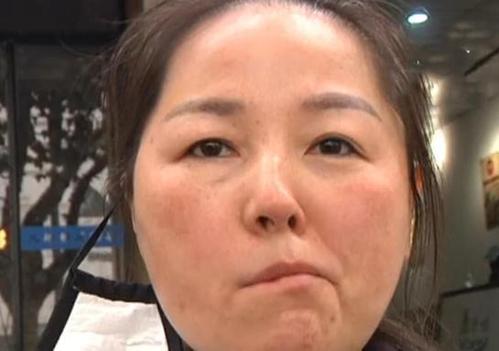 脑血管堵塞,脸知道:脸上出现三个变化,别拖,脑梗要来了