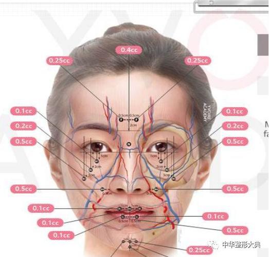 面部中轴之玻尿酸填充的设计方法
