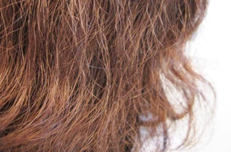 头发干枯毛躁是身体缺少什么