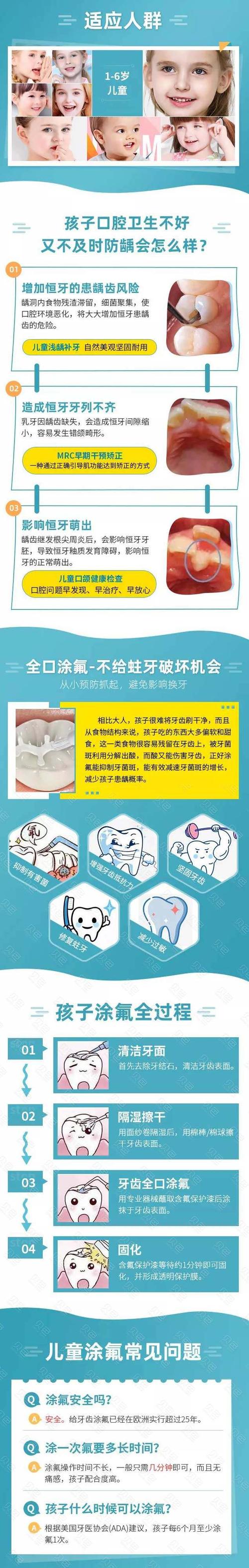 儿童全口凃氟儿童进口涂氟预防蛀牙