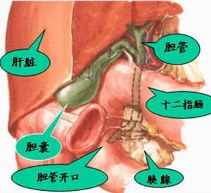 如何选择胆囊结石的治疗方法?