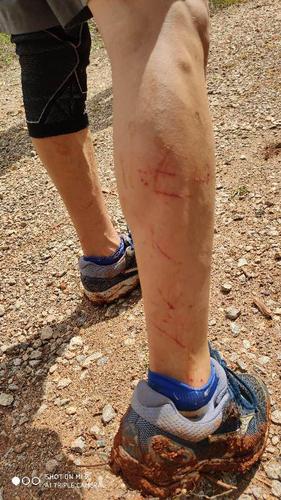 这是徐飞的小腿跳下去的时候,被树枝划破了几道伤口,大家全部安全翻墙