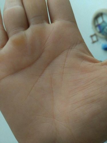 我,女,29,两只手生命线都很短有正常人一半是否生命很短求解?