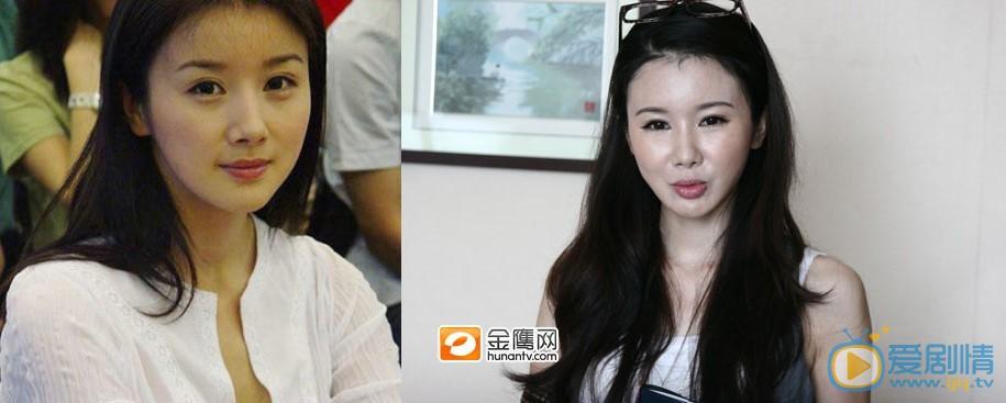 孙菲菲整容了吗?孙菲菲整容前后对比及早年照片