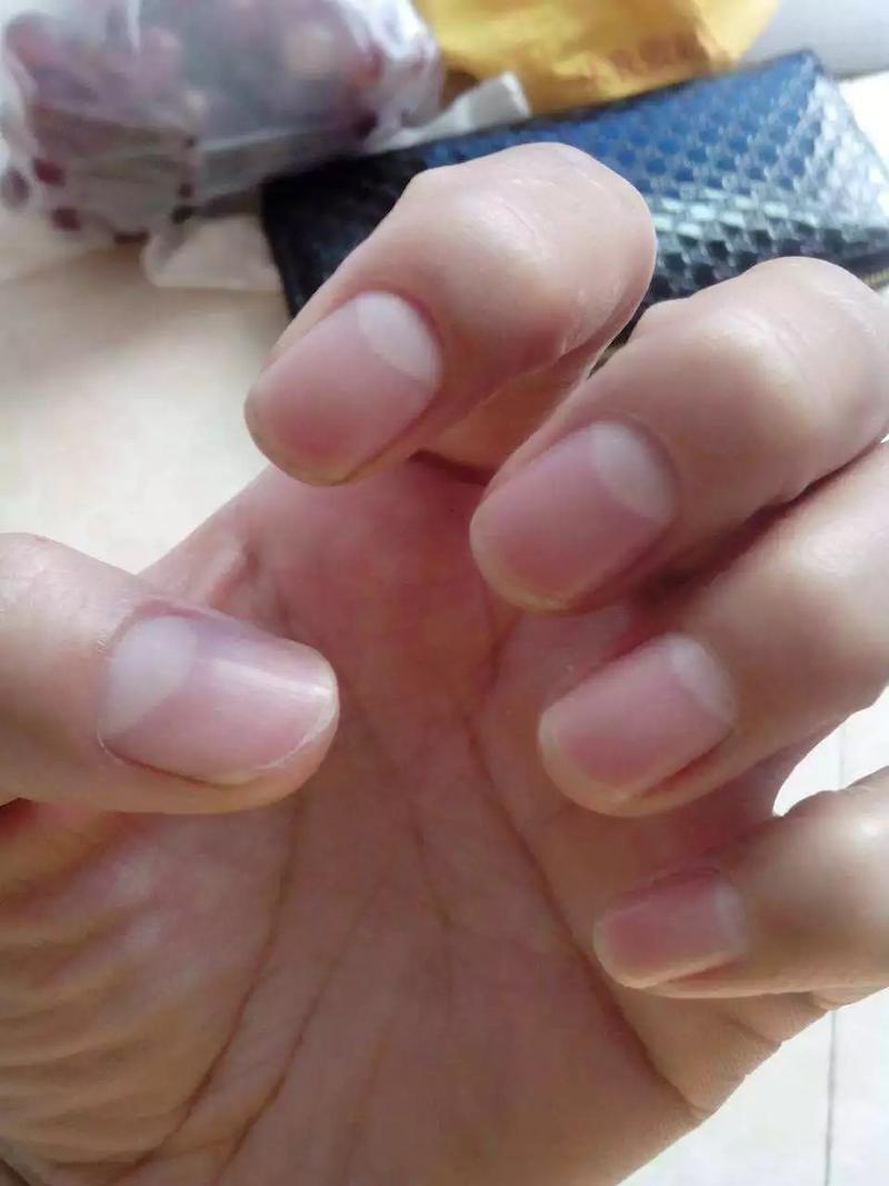 苗族生息 | 关于指甲的月牙白,你了解多少?