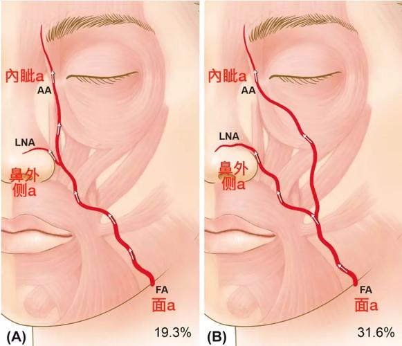 脑血管解剖学习笔记第20期面动脉面部走行和分支