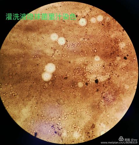 新型隐球菌