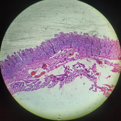 肠粘膜瘀血组织切片