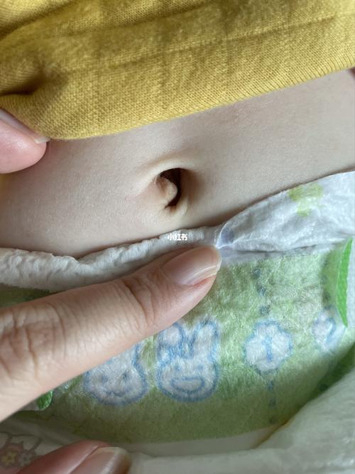 妈妈们你们的宝宝肚脐眼是什么样子的,桃子的肚脐眼有块凸起的小肉肉