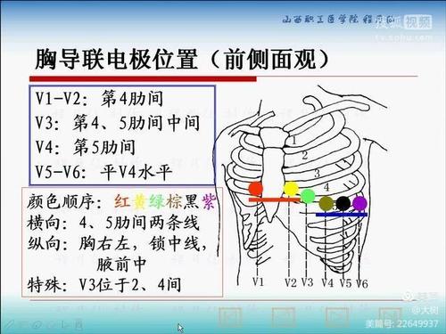 心电图导联位置图解大全 心电图导联连接快速确定位置
