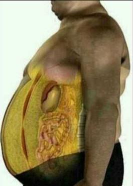 腹部肥胖的朋友肚子里面就是上面图片的那样子!