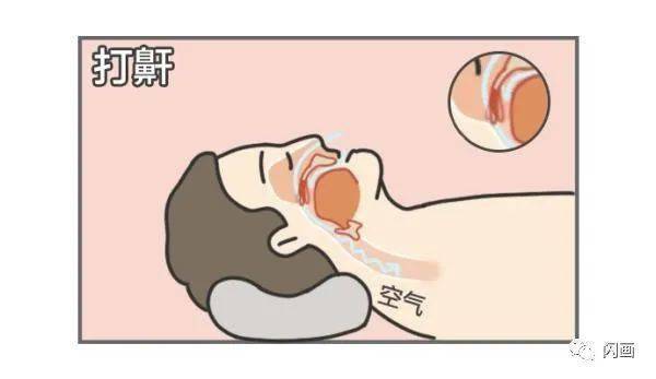 什么人容易打呼噜