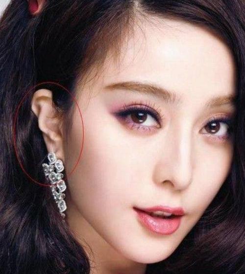 娱乐圈里的残疾人,吴京断手指,范冰冰耳朵外翻,而她因