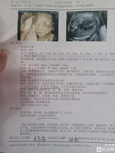 羊水穿刺结果出来了,一切正常