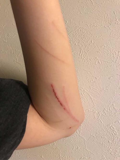 爱猫的主子,你们会被猫无意识的抓伤么?