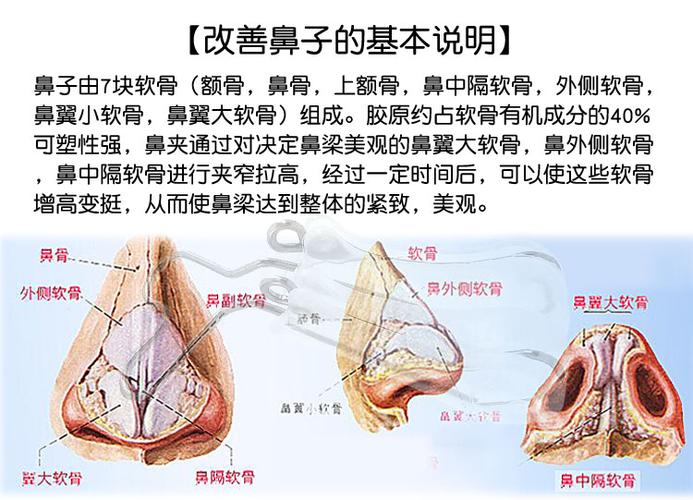 【含夹和按摩轮】高鼻梁增高器夹鼻子鼻孔瘦鼻翼缩小隆鼻翘鼻夹挺鼻器