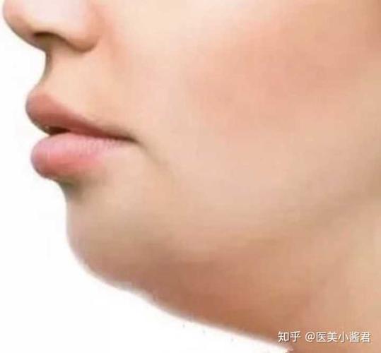 怎样才能练成完美的下颚线