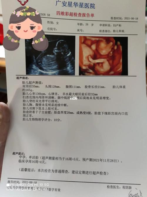 16周的b超_b超_孕吐_怀孕_母婴_孕产经验