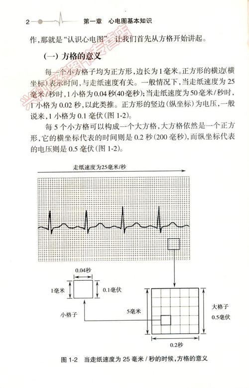 心电图图形顺序解读 心电图书籍心电图图解速成讲授心电图学轻松学习