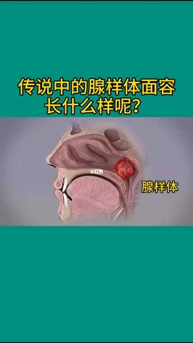 腺体长啥样_鼻炎_抗鼻炎经验_医疗健康_医疗健康其他