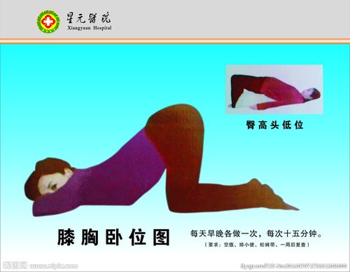 膝胸位图片