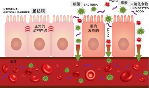 在正常情况下,紧密连结的肠粘膜细胞就是我们与外界的屏障,细菌,毒素