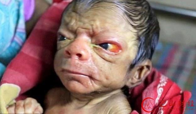 父母疑似近亲结婚 生下一个"外星人"