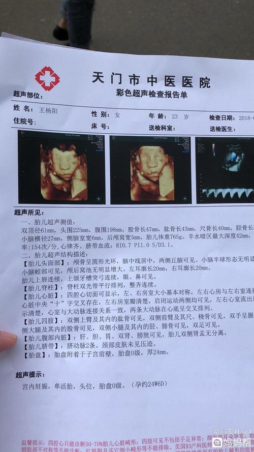 有没有会看四维的 看我宝宝嘴巴