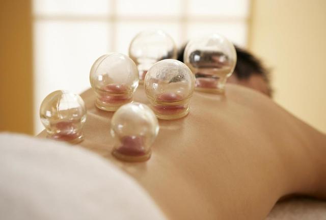 拔火罐时,后背出现的瘀血,是排出的毒素吗?不懂的来看看吧