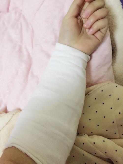 做饭油溅到了,担心以后留疤痕,在瑞金医院换药包扎花了300多了,礼拜三